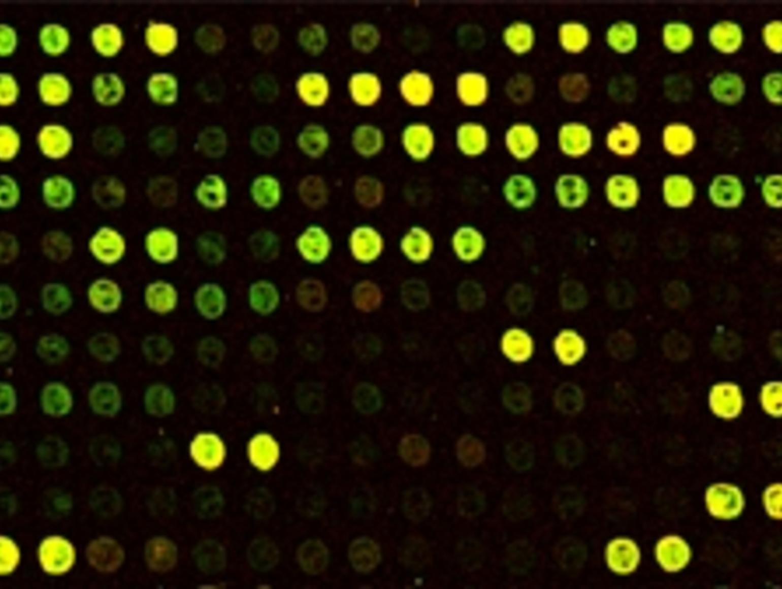 Microarray Bacterial Prospective Students and Postdocs | Edwards Laboratory OEB/MCZ
